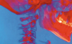 Tyler, Texas chiropractor, quality chiropractic to obtain wellness.
